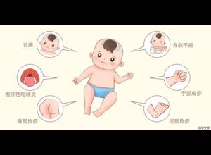 手足口病来袭！