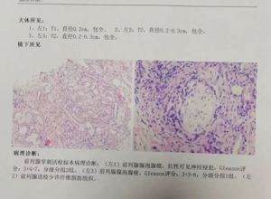 耒阳市首例！掌握“金标准”，患者少跑路